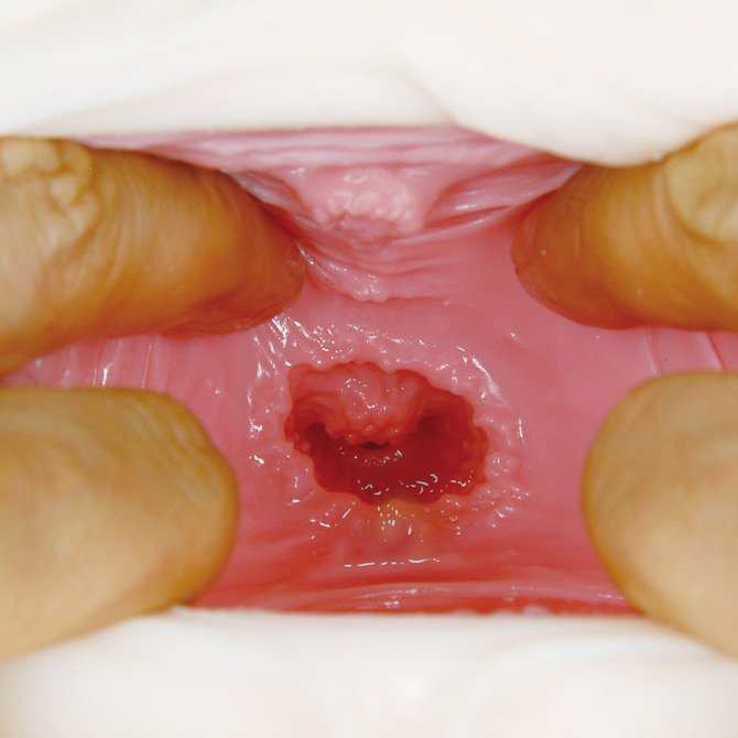 Japan Artificial Vagina Male Masturbator Vaginal for Men Meiki No Saigen Marugoto Aika Real Size Pocket Pussy Sex Toys for Man Oh 1817 508