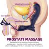10 Speeds Rechargeable Remote Control Prostata Massager for Men Gay Anal Butt Plugs Rechargeable Prostata Vibrator for Men Wireless Anal Sex Toys