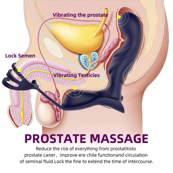 10 Speeds Rechargeable Remote Control Prostata Massager for Men Gay Anal Butt Plugs Rechargeable Prostata Vibrator for Men Wireless Anal Sex Toys